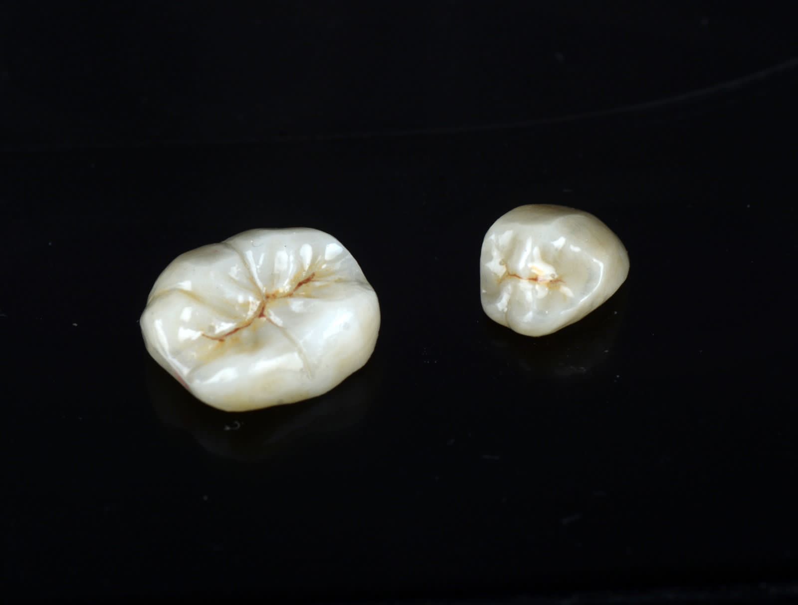 Single-unit zirconia restorations photographed on a black background