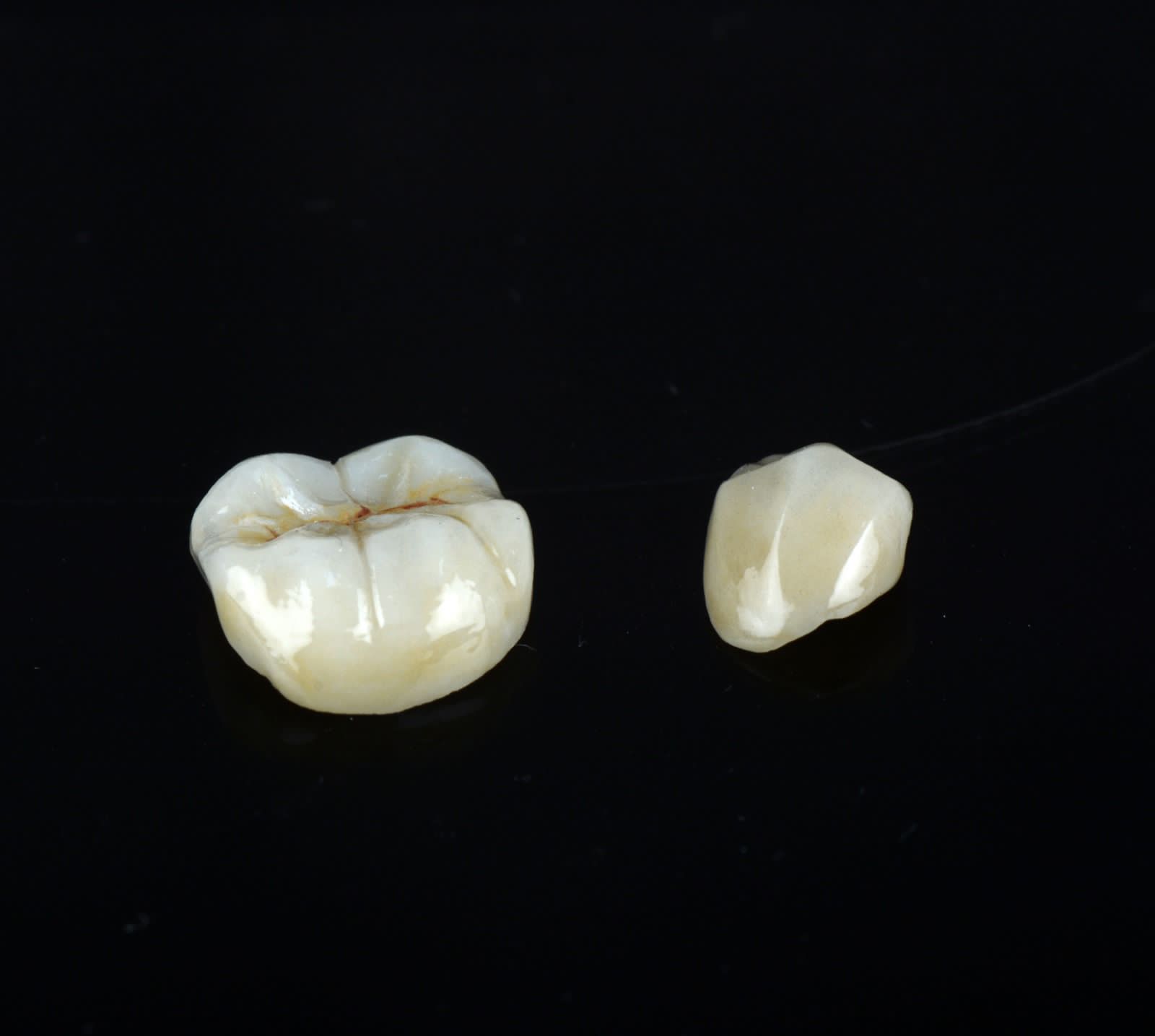 Single-unit restorations with polished anatomy on a dark background