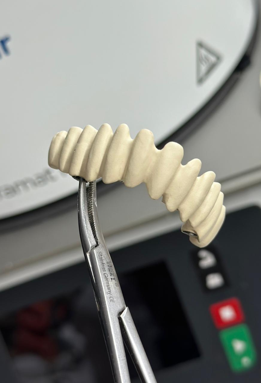 Multi-unit bridge framework held for finishing