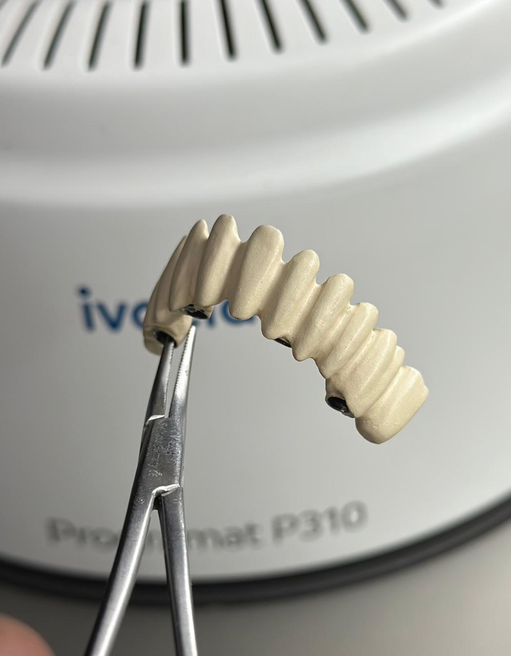 Multi-unit bridge restoration held with forceps in a lab setting