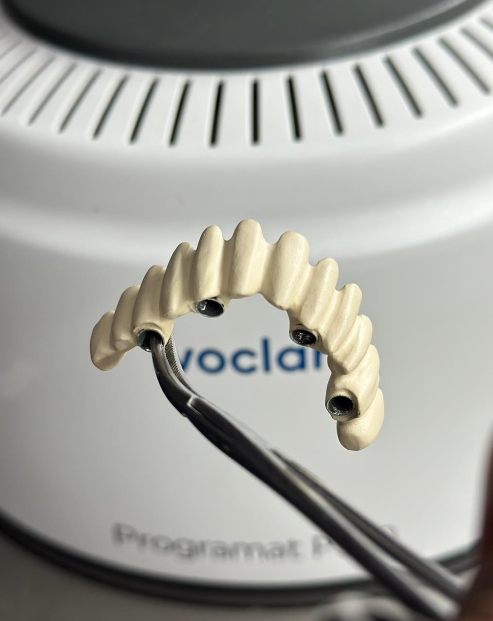 Multi-unit implant bridge framework photographed during lab finishing
